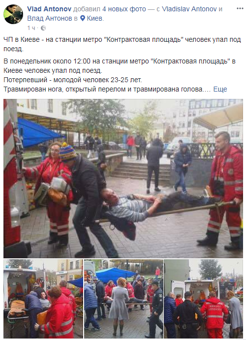 Стало известно о состоянии пассажира киевского метро, который упал под поезд